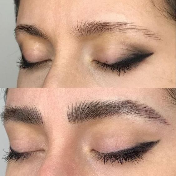 Turn thin, sparse, patchy and overplucked eyebrows into full, thick, shapely and expressive eyebrows with Dermaworks advanced eyebrow enhancing serum.